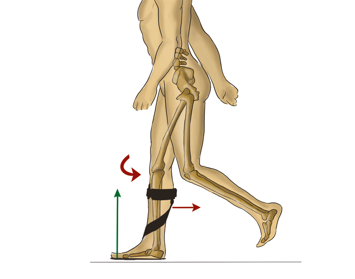 Releveur de pied Dynamic à dorsi-flexion réglable