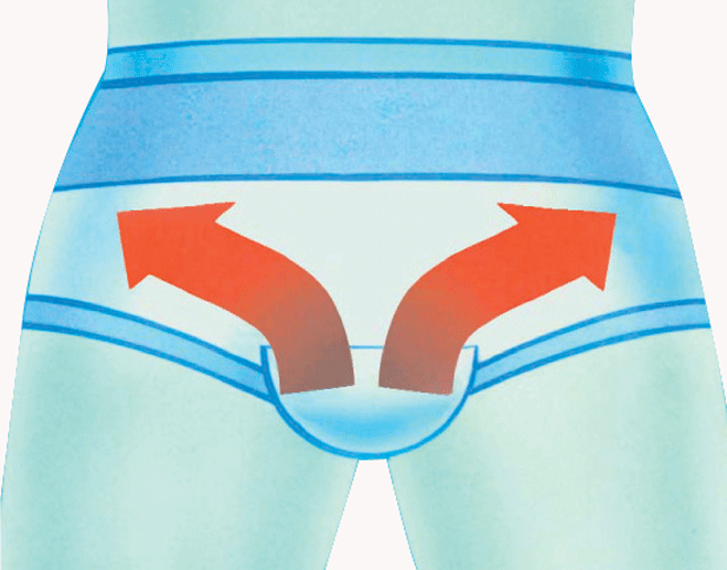 Slip herniaire post-opératoire ErniaSlip post-op 2
