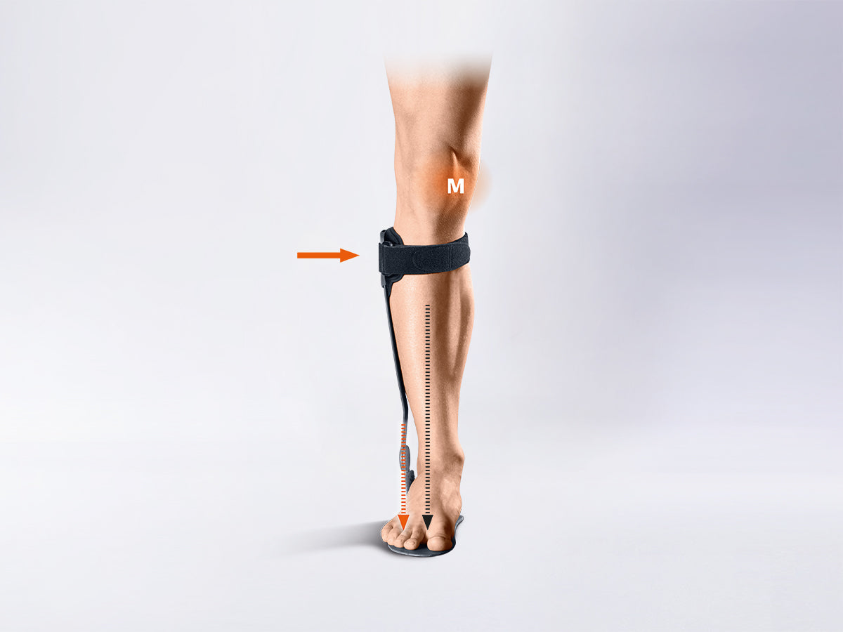 Ankle brace for the treatment of gonarthrosis by compartmental unloading Kneo