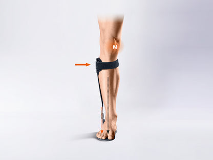 Ankle brace for the treatment of gonarthrosis by compartmental unloading Kneo