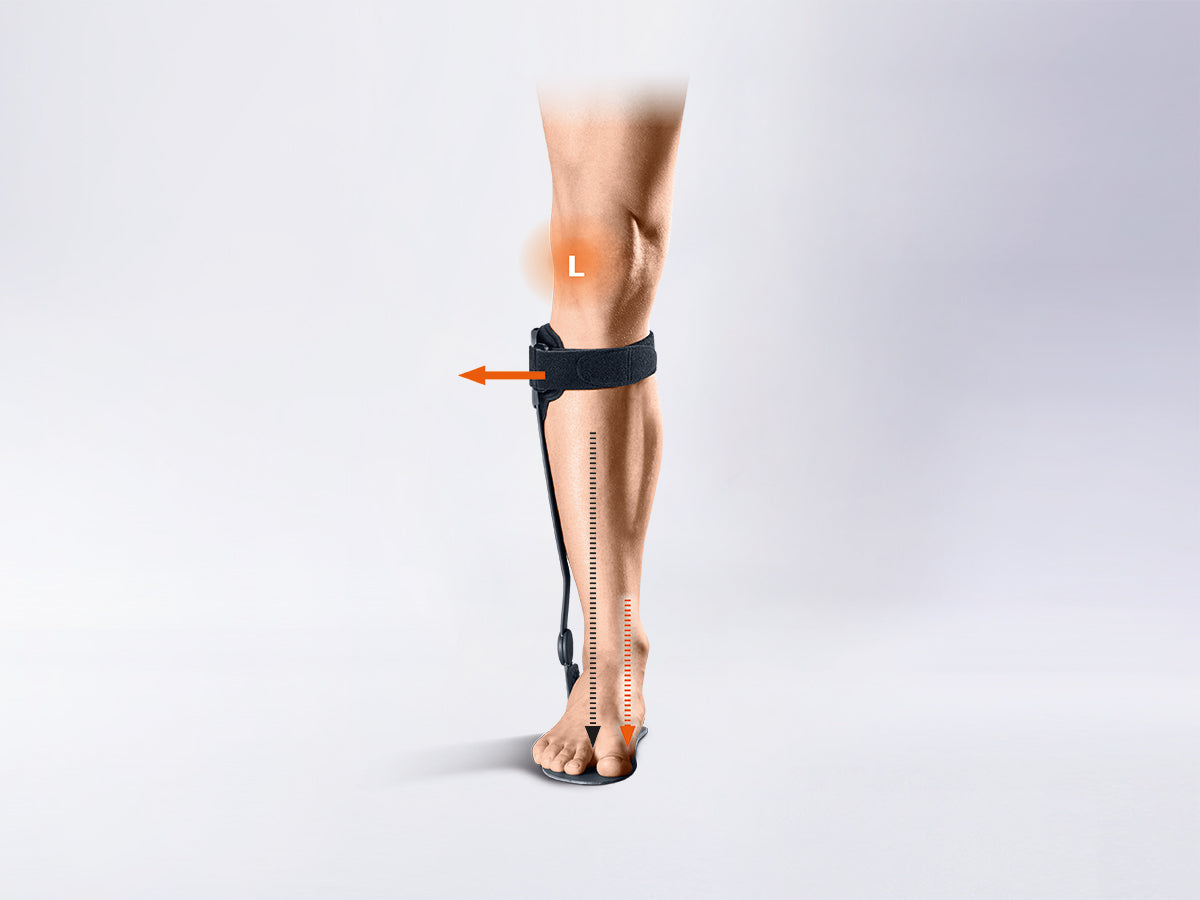 Ankle brace for the treatment of gonarthrosis by compartmental unloading Kneo