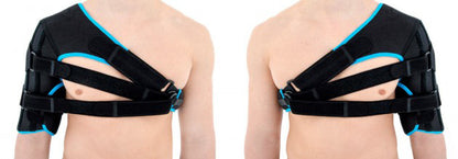1-2-3 progressive shoulder brace for humerus fracture