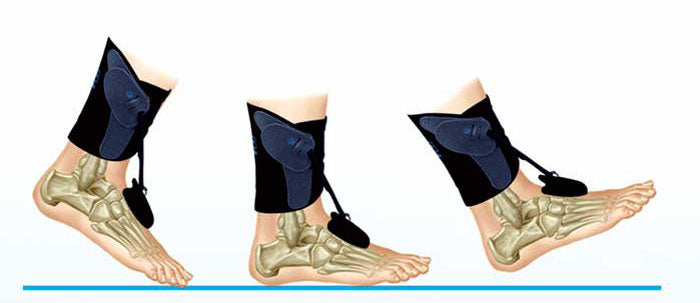 Releveur de pied dynamique AirMed avec fixation FS3000 (option)