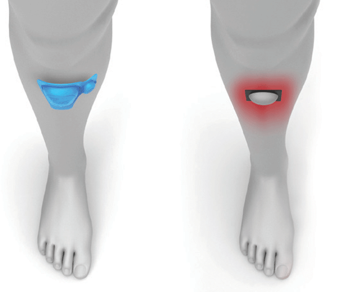 Botte de marche pneumatique Walker Gen2
