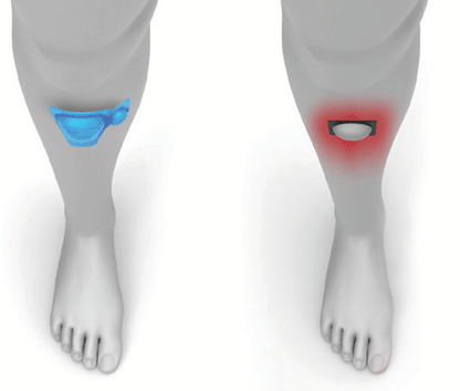 Botte de marche pneumatique Walker Gen2